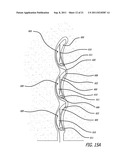 ANCHORS FOR USE IN MEDICAL APPLICATIONS diagram and image