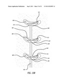 ANCHORS FOR USE IN MEDICAL APPLICATIONS diagram and image