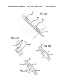 ANCHORS FOR USE IN MEDICAL APPLICATIONS diagram and image