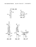 ANCHORS FOR USE IN MEDICAL APPLICATIONS diagram and image