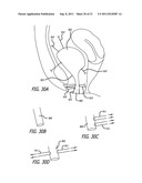 ANCHORS FOR USE IN MEDICAL APPLICATIONS diagram and image