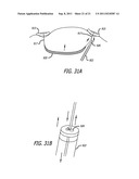 ANCHORS FOR USE IN MEDICAL APPLICATIONS diagram and image