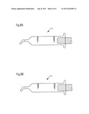 Device for sealing and drainage of a natural or artificial intestinal     outlet diagram and image