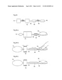 APPARATUS AND METHOD FOR TREATING GERD diagram and image