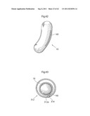 APPARATUS AND METHOD FOR TREATING GERD diagram and image