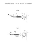 APPARATUS AND METHOD FOR TREATING GERD diagram and image