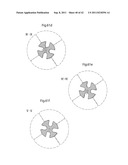 APPARATUS AND METHOD FOR TREATING GERD diagram and image