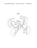 APPARATUS AND METHOD FOR TREATING GERD diagram and image