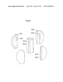 APPARATUS AND METHOD FOR TREATING GERD diagram and image