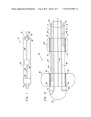 PRESSURE-PROPELLED SYSTEM FOR BODY LUMEN diagram and image