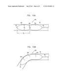 PRESSURE-PROPELLED SYSTEM FOR BODY LUMEN diagram and image