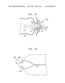 PRESSURE-PROPELLED SYSTEM FOR BODY LUMEN diagram and image