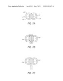 APPARATUS AND METHOD FOR GASTRIC BYPASS SURGERY diagram and image