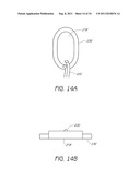 APPARATUS AND METHOD FOR GASTRIC BYPASS SURGERY diagram and image