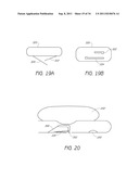 APPARATUS AND METHOD FOR GASTRIC BYPASS SURGERY diagram and image