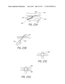 APPARATUS AND METHOD FOR GASTRIC BYPASS SURGERY diagram and image