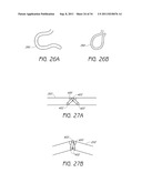 APPARATUS AND METHOD FOR GASTRIC BYPASS SURGERY diagram and image