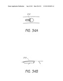 APPARATUS AND METHOD FOR GASTRIC BYPASS SURGERY diagram and image