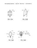 APPARATUS AND METHOD FOR GASTRIC BYPASS SURGERY diagram and image