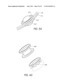 APPARATUS AND METHOD FOR GASTRIC BYPASS SURGERY diagram and image