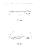 APPARATUS AND METHOD FOR GASTRIC BYPASS SURGERY diagram and image