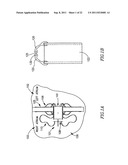 DEVICE AND METHOD FOR CONTROLLING IN-VIVO PRESSURE diagram and image