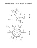 DEVICE AND METHOD FOR CONTROLLING IN-VIVO PRESSURE diagram and image