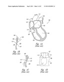 SYSTEMS AND METHODS FOR TRANSEPTAL CARDIAC PROCEDURES, INCLUDING     ADJUSTABLE, SEPARABLE GUIDEWIRES diagram and image