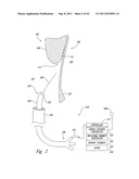 SYSTEMS AND METHODS FOR TRANSEPTAL CARDIAC PROCEDURES, INCLUDING     ADJUSTABLE, SEPARABLE GUIDEWIRES diagram and image