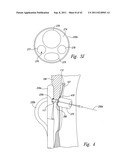 SYSTEMS AND METHODS FOR TRANSEPTAL CARDIAC PROCEDURES, INCLUDING     ADJUSTABLE, SEPARABLE GUIDEWIRES diagram and image