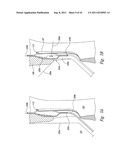 SYSTEMS AND METHODS FOR TRANSEPTAL CARDIAC PROCEDURES, INCLUDING     ADJUSTABLE, SEPARABLE GUIDEWIRES diagram and image