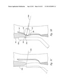 SYSTEMS AND METHODS FOR TRANSEPTAL CARDIAC PROCEDURES, INCLUDING     ADJUSTABLE, SEPARABLE GUIDEWIRES diagram and image