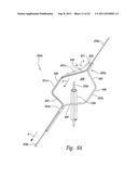 SYSTEMS AND METHODS FOR TRANSEPTAL CARDIAC PROCEDURES, INCLUDING     ADJUSTABLE, SEPARABLE GUIDEWIRES diagram and image