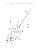 SYSTEMS AND METHODS FOR TRANSEPTAL CARDIAC PROCEDURES, INCLUDING     ADJUSTABLE, SEPARABLE GUIDEWIRES diagram and image