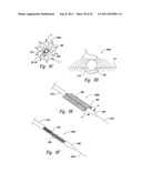 SYSTEMS AND METHODS FOR TRANSEPTAL CARDIAC PROCEDURES, INCLUDING     ADJUSTABLE, SEPARABLE GUIDEWIRES diagram and image