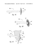 SYSTEMS AND METHODS FOR TRANSEPTAL CARDIAC PROCEDURES, INCLUDING     ADJUSTABLE, SEPARABLE GUIDEWIRES diagram and image