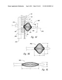 SYSTEMS AND METHODS FOR TRANSEPTAL CARDIAC PROCEDURES, INCLUDING     ADJUSTABLE, SEPARABLE GUIDEWIRES diagram and image