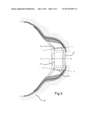 TO CONTROL BENDING IN A SKIN PLATE FOR USE IN AN OSTOMY APPLIANCE diagram and image