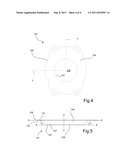 TO CONTROL BENDING IN A SKIN PLATE FOR USE IN AN OSTOMY APPLIANCE diagram and image