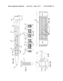 ENDOSTEAL NAIL PLATE FOR FIXING BONE SEGMENTS diagram and image