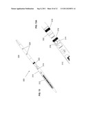 ENDOSTEAL NAIL PLATE FOR FIXING BONE SEGMENTS diagram and image