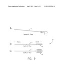 METHOD AND SYSTEM FOR SHAVING BONE diagram and image