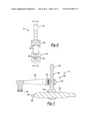 Method and Apparatus for Preparing a Proximal Femur diagram and image