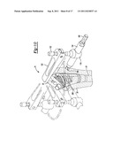 Method and Apparatus for Preparing a Proximal Femur diagram and image