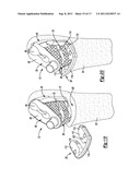 Method and Apparatus for Preparing a Proximal Femur diagram and image