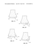 Patient Selectable Joint Arthroplasty Devices and Surgical Tools diagram and image