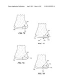 Patient Selectable Joint Arthroplasty Devices and Surgical Tools diagram and image