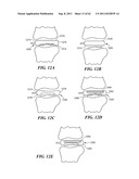 Patient Selectable Joint Arthroplasty Devices and Surgical Tools diagram and image