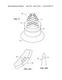 Patient Selectable Joint Arthroplasty Devices and Surgical Tools diagram and image