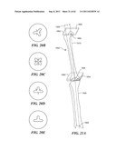 Patient Selectable Joint Arthroplasty Devices and Surgical Tools diagram and image